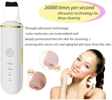 Ultrasonic Blackhead Pore Cleaner