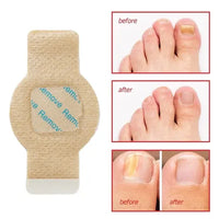 #1 Fungal Nail Patches